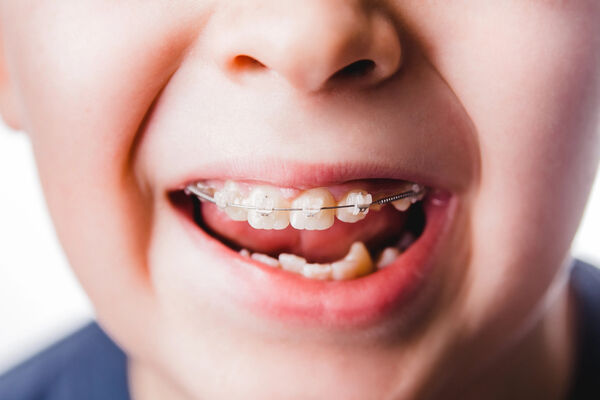 Children's Orthodontics